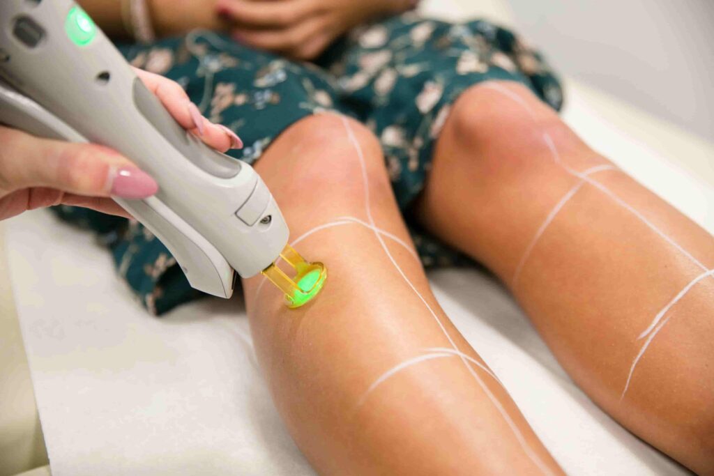 Female Laser Hair Removal