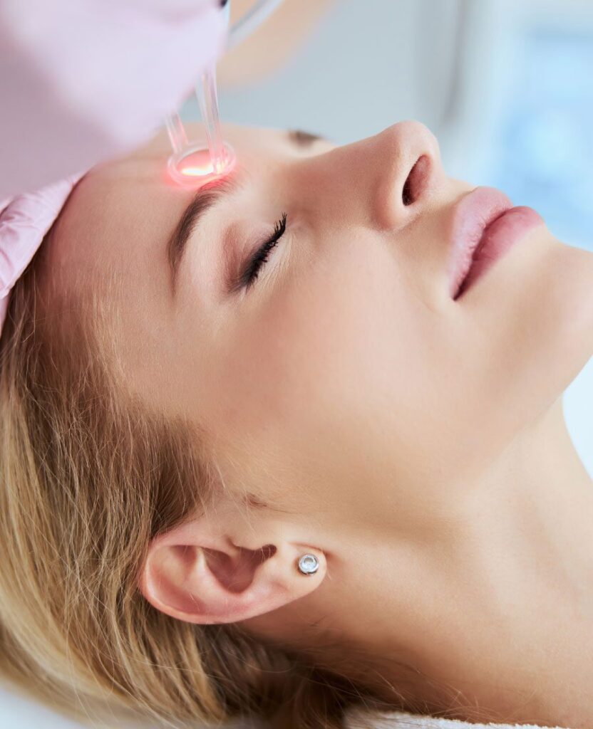 Fractional CO2 Laser Treatment